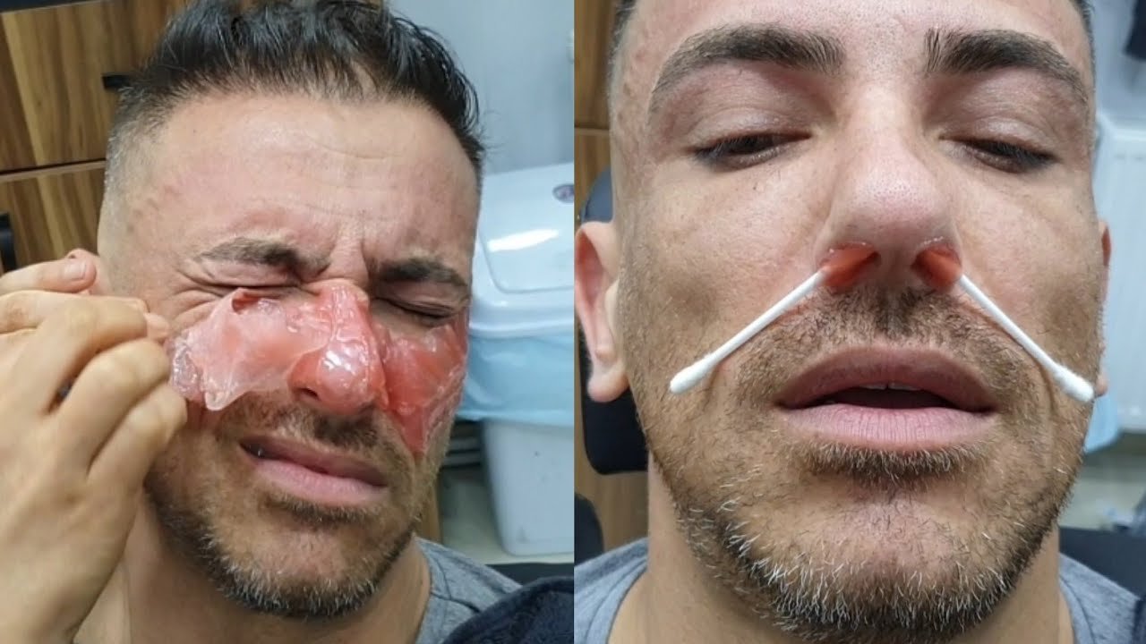 Amazing Waxing Eyebrow Full Face Waxing For Men - YouTube Amazing Waxing Eyebrow Full Face Waxing For Men - Youtube