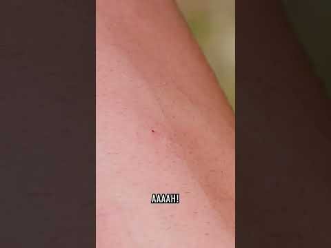 Giant Hornet STUNG Me!